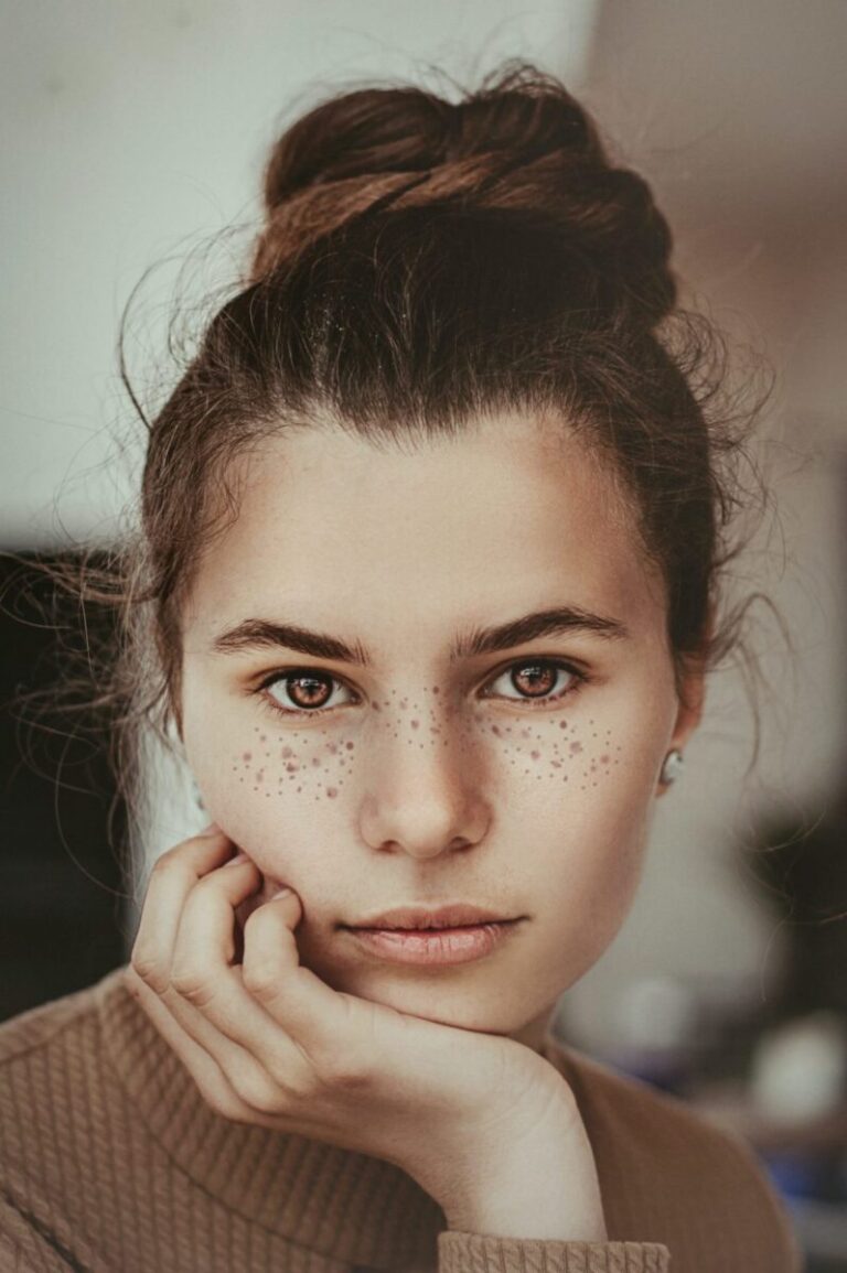 A young woman with freckles on her face.